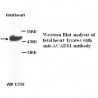 ACADM Antibody