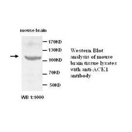 ACK1 Antibody