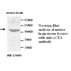 ACK1 Antibody