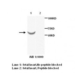 ACTR1B Antibody