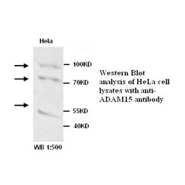 ADAM15 Antibody
