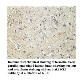 ALS2CR2 Antibody