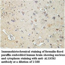 ALS2CR2 Antibody