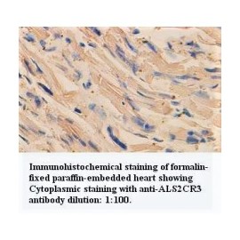 ALS2CR3 Antibody