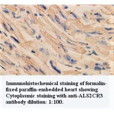 ALS2CR3 Antibody