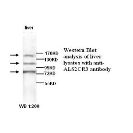 ALS2CR2 Antibody