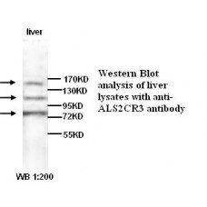 ALS2CR2 Antibody