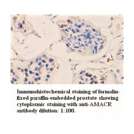 AMACR Antibody
