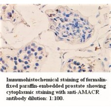 AMACR Antibody