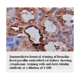 Beta tubulin Antibody