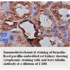 Beta tubulin Antibody