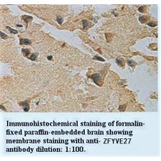 ZFYVE27 Antibody