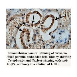DCP2 Antibody