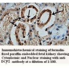 DCP2 Antibody
