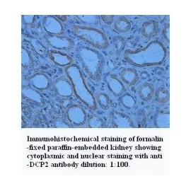DCP2 Antibody