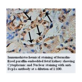 DCP1A Antibody