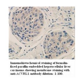 ACVRL1 Antibody