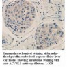 ACVRL1 Antibody