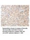 ADAM15 Antibody
