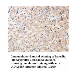 ADAM15 Antibody