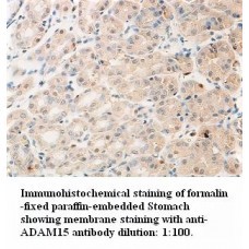 ADAM15 Antibody