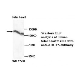 ADCY6 Antibody
