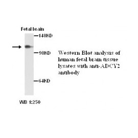 ADCY2 Antibody