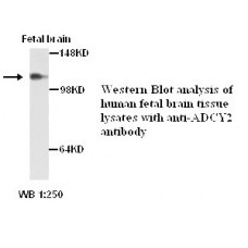 ADCY2 Antibody