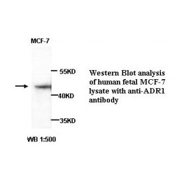 ADIPOR1 Antibody