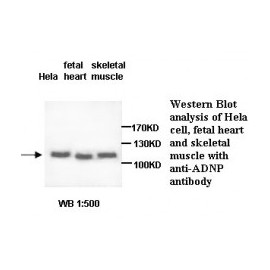 ADIPOR1 Antibody