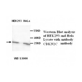 AICDA Antibody