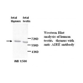 AIRE Antibody