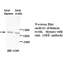 AIRE Antibody