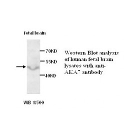 AKAP10 Antibody