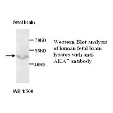 AKAP10 Antibody