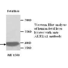 AKR1A1 Antibody