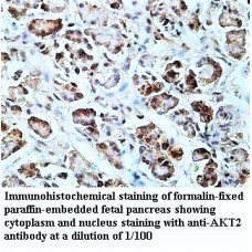 AKT2 Antibody