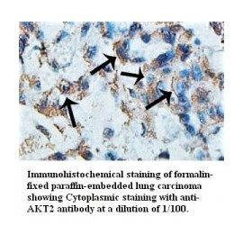 AKT2 Antibody