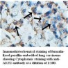 AKT2 Antibody