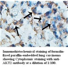 AKT2 Antibody