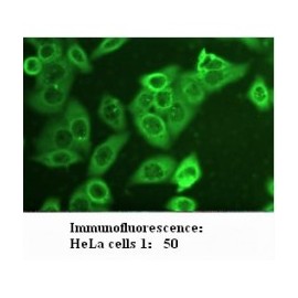 AKT1 Antibody