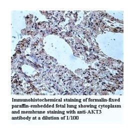 AKT3 Antibody
