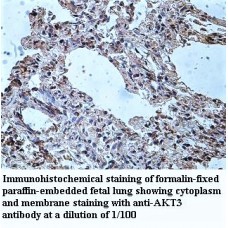 AKT3 Antibody