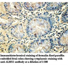 ALMS1 Antibody