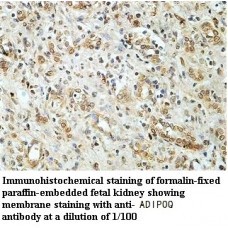 Adiponectin Antibody