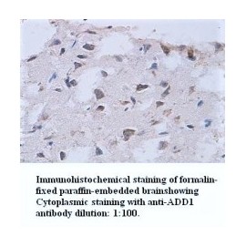  Alpha Adducin Antibody