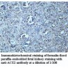 ACE2 Antibody
