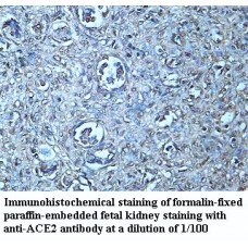  ACE2 Antibody