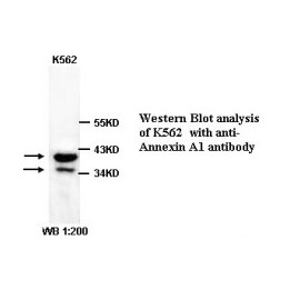 ANK1 Antibody