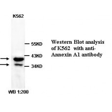 ANK1 Antibody